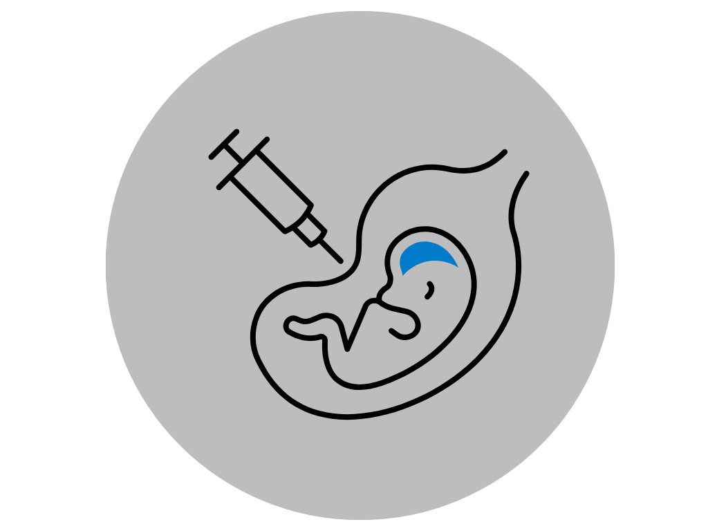 Amniocentesis